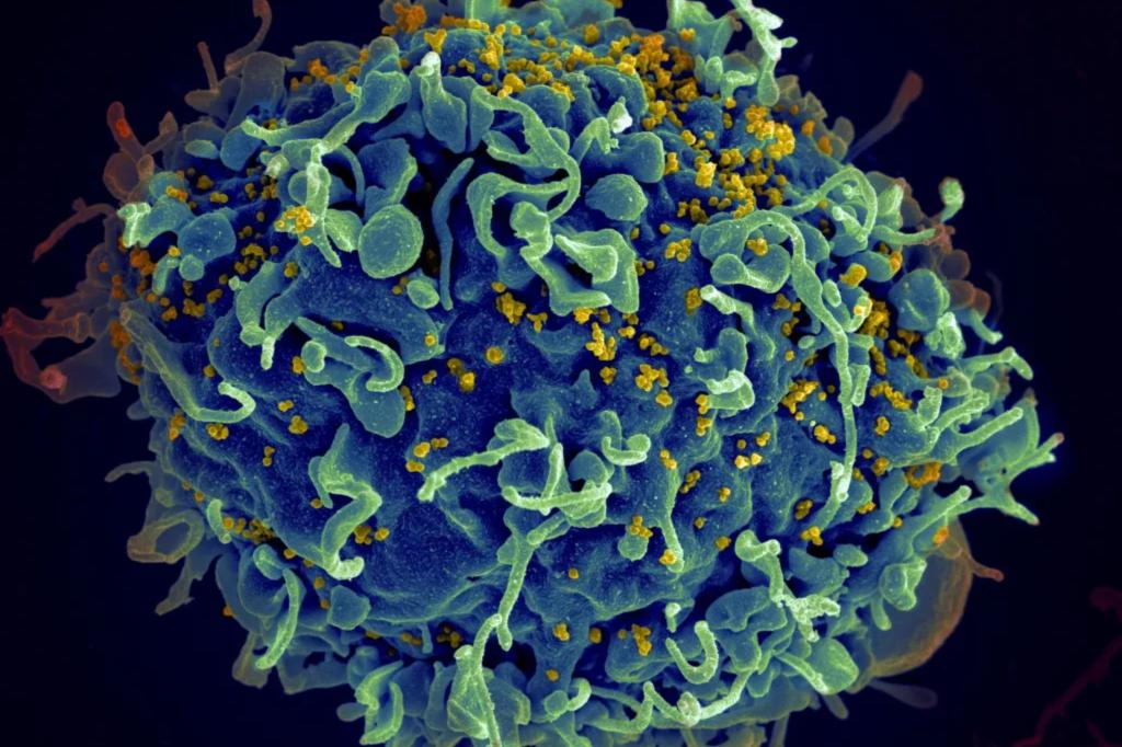 The 7th person is likely to be 'cured' of HIV in an exceptional case